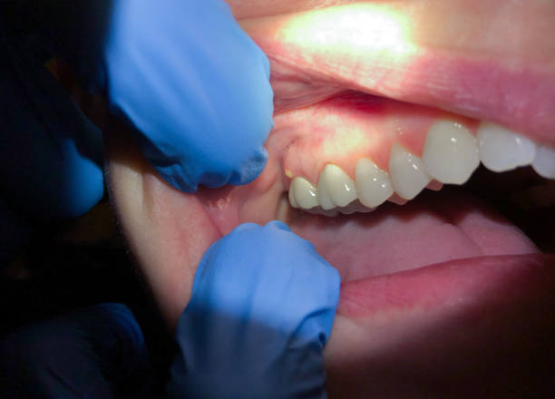 Best Urgent Care for Lost Fillings or Crowns in Forreston, IL